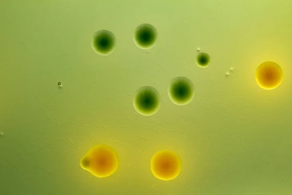 Closeup for plate Bacteria culture growth on Selective media, vi