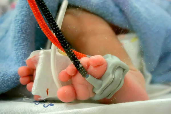 Sick newborn crisis baby foot Insert a Oxygen strap and saline to measure oxygen in the blood and see the oxygen value for organs.