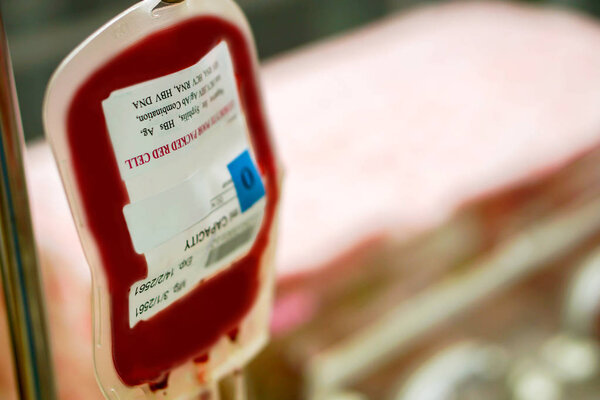 Closeup blood in a bag hanging on a pole is transferring blood to a sick newborn baby in a hospital.