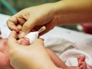 Tuzlu çözüm ve tıp Medikal yapıştırıcı sıva hasta yeni doğan bebeğin yandan kullanarak güvenli bir şekilde hazırlama için hemşire eller doldurun.
