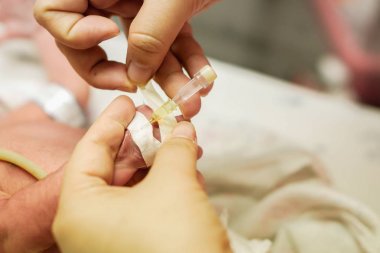 Hemşire el tıbbi yapıştırıcı kullanarak sopa alçı ve güvenli bir şekilde tuzlu çözüm ve tıp IV kateter ve hasta yeni doğan bebeğin el hazırla doldurmak için şal.
