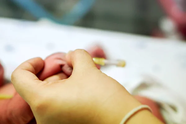 Mãos Enfermeira Pressionam Cateter Mãos Bebê Recém Nascido Doente Para — Fotografia de Stock