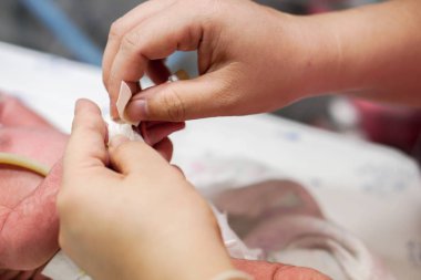 Hemşire el tıbbi yapıştırıcı kullanarak sopa alçı ve güvenli bir şekilde tuzlu çözüm ve tıp IV kateter ve hasta yeni doğan bebeğin el hazırla doldurmak için şal.