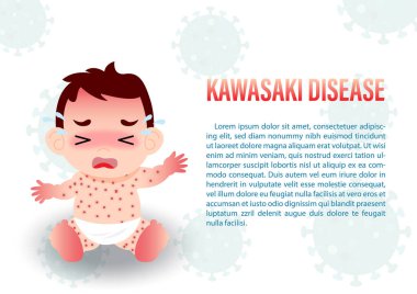 Download Kawasaki Disease Free Vector Eps Cdr Ai Svg Vector Illustration Graphic Art