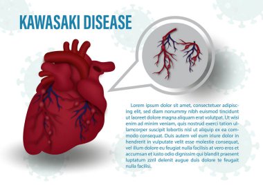 Download Kawasaki Disease Free Vector Eps Cdr Ai Svg Vector Illustration Graphic Art