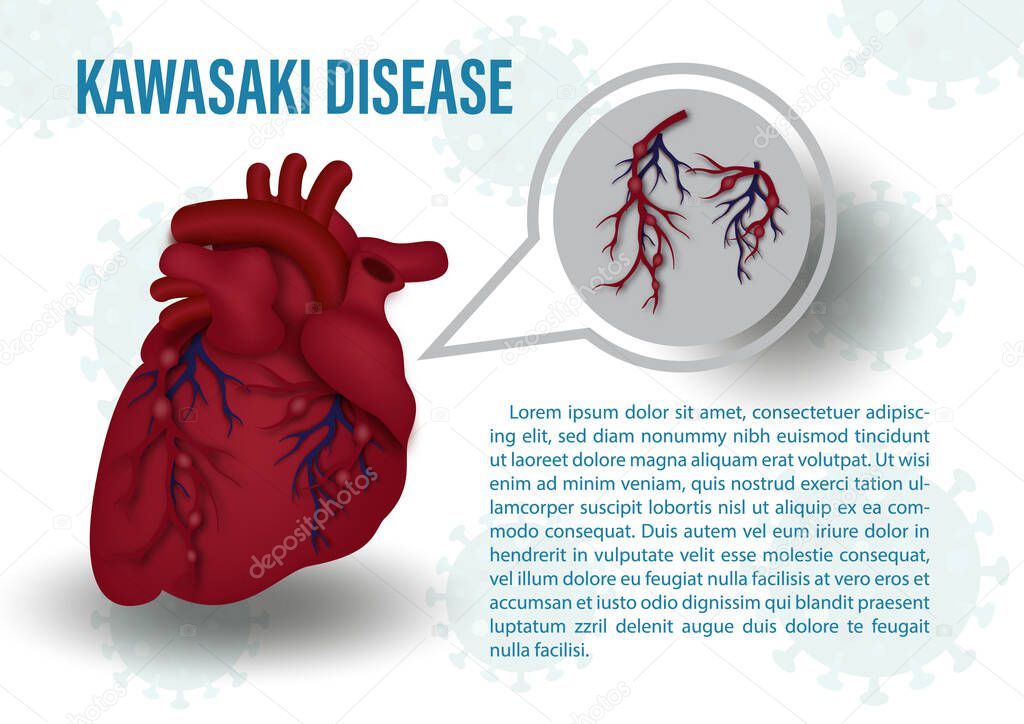 Closeup human heart with the Kawasaki Symptoms at red blood vessels, the name and example texts on virus symbols and white background. Medical's poster of the Kawasaki disease in vector design.