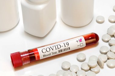 COVID-19 pozitif sonuç testi ve teşhis koronavirüs enfeksiyonu ve ilaçlar için laboratuvar örneği