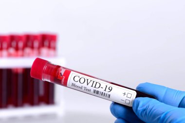 KOVID-19 test ve teşhis koronavirüs enfeksiyonu için yapılan kan testinin laboratuvar numunesi beyaz arka planda ve reklam konsepti için izole edilmiş laboratuvar asistanının ellerinde.