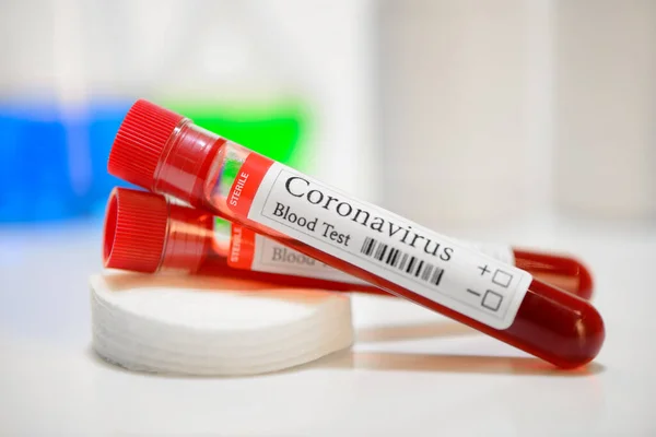 Covid Test Laboratory Sample Blood Testing Diagnosis Coronavirus Infection — Stock Photo, Image