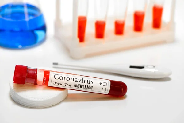 Covid Test Laboratory Sample Blood Testing Diagnosis Coronavirus Infection Thermometer — Stock Photo, Image