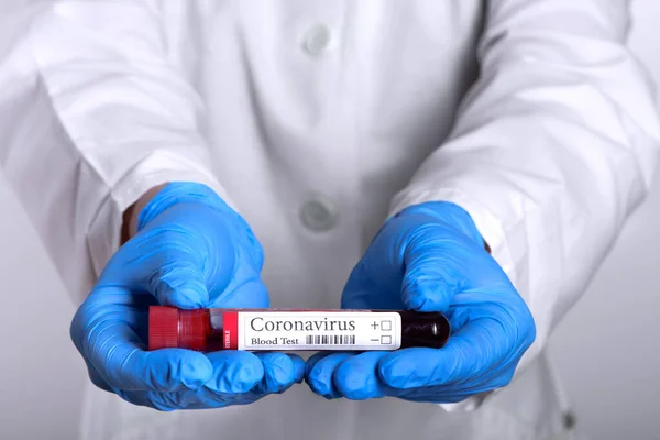 Covid Test Laboratory Sample Blood Testing Diagnosis Coronavirus Infection Hands — Stock Photo, Image