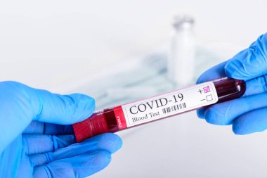 COVID-19 pozitif test ve teşhis koronavirüsü enfeksiyonu için laboratuvar numunesi beyaz arka plan ve reklam konsepti için izole edilmiş laboratuvar asistanının ellerinde.