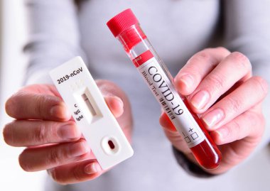 Rapid Covid-19 Coronavirus test kaseti antikor veya sars-cov-2 virüs hastalığı ve kan testi tüpü için yakın plan el salgını konsepti
