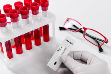 Hızlı Covid-19 Coronavirus test kaseti antikor veya sars-cov-2 virüs hastalığı için elimizde ve kan testi tüpü salgını konsepti yakın plan