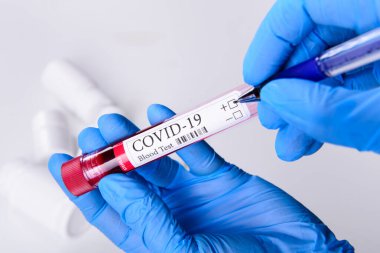 Covid-19 Coronavirus Hastalığı. Kan testi tüpü. Salgın konsepti.
