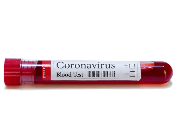 Covid Test Laboratory Sample Blood Testing Diagnosis Coronavirus Infection Isolated — Stock Photo, Image