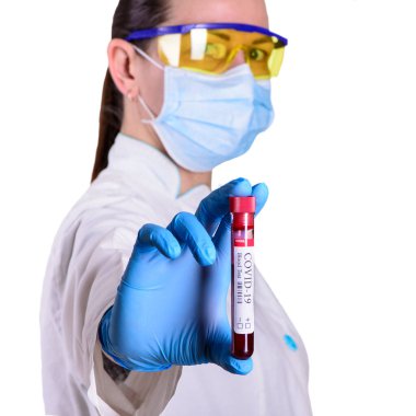 KOVID-19, laboratuvar asistanı kadının ellerinde Coronavirus enfeksiyonu teşhisi için yapılan kan testi ve laboratuvar örneği.