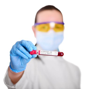 KOVID-19, laboratuvar asistanı kadının ellerinde Coronavirus enfeksiyonu teşhisi için yapılan kan testi ve laboratuvar örneği.