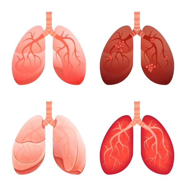 Conjunto de ícones pulmonares, estilo cartoon —  Vetores de Stock