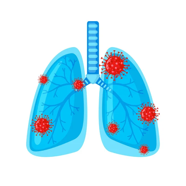 Icona Polmoni Umani Con Batteri Coronavirus Stile Piatto Isolati Sfondo — Vettoriale Stock