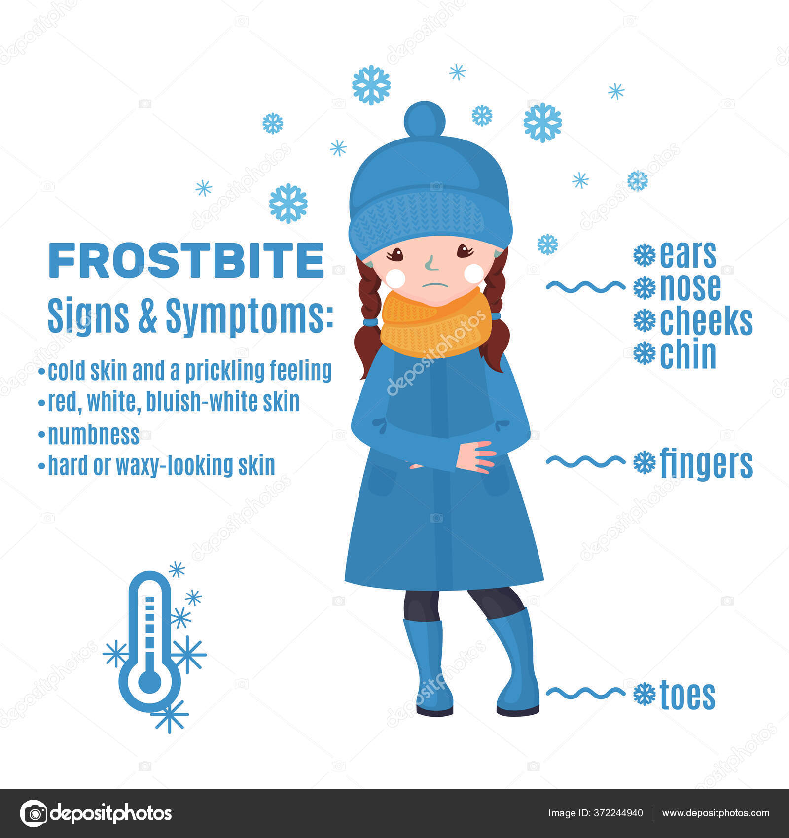 Frostbite Infographic Cartoon Style Isolated White Background Vector  Illustration Stock Vector by ©7romawka7 372244940