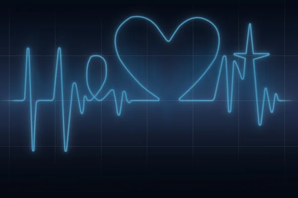 心臓心電図のグラフ — ストック写真