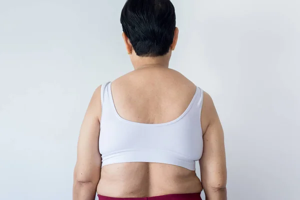 Mujer Mayor Con Sobrepeso Pellizcando Cuerpo Gordo Celulitis Apretando Grasa — Foto de Stock