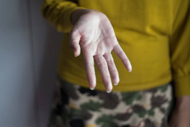 Eli olan kadın pullu deriyi, sağlık derisi konseptini çıkarıp kapatıyor.