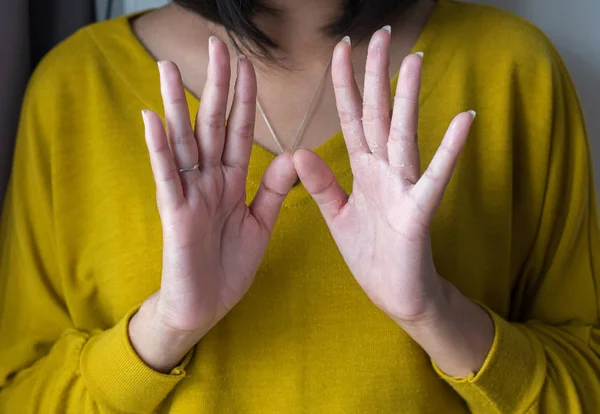 Vrouw Met Hand Verwijdert Schilferige Huid Gezondheidszorg Huidconcept Close — Stockfoto