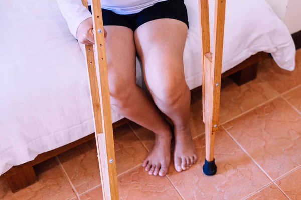 Mulher Paciente Usando Muletas Pernas Quebradas Para Andar Quarto Close — Fotografia de Stock