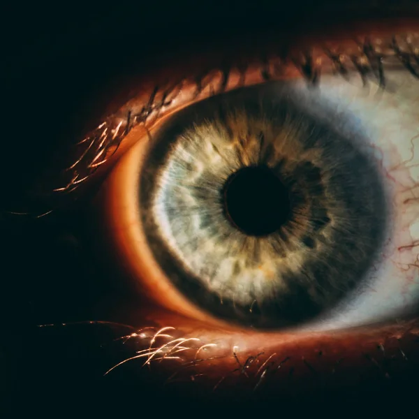 Enlarged image of an eye iris made with a slit lamp — Stock Photo, Image