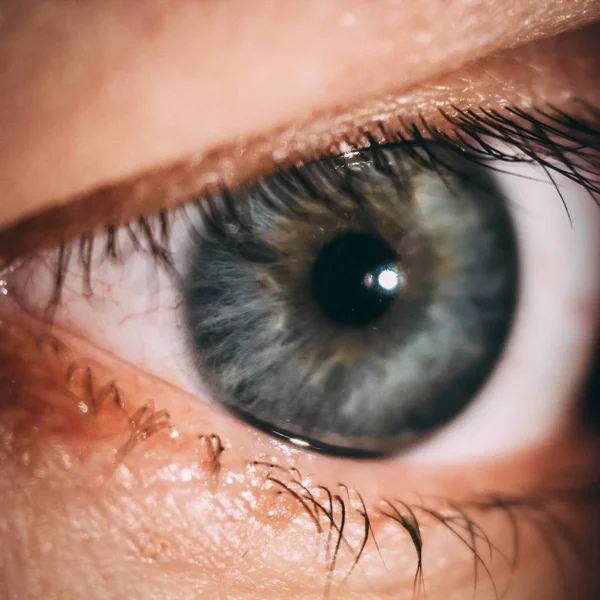 Slit lamba ile yapılan bir göz iris büyütülmüş görüntü — Stok fotoğraf