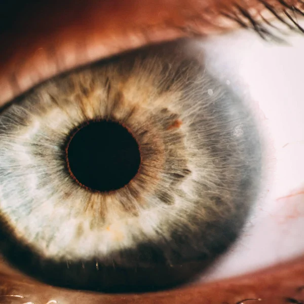 Enlarged image of an eye iris made with a slit lamp — Stock Photo, Image