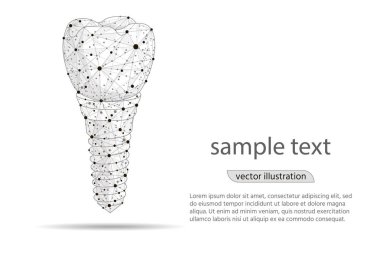 soyut tasarım diş implantı kutsal kişilerin resmi, beyaz arka plan üzerinde düşük Poli tel kafes üzerinden izole. Vektör soyut poligonal görüntü mash çizgi ve nokta. Dijital grafik