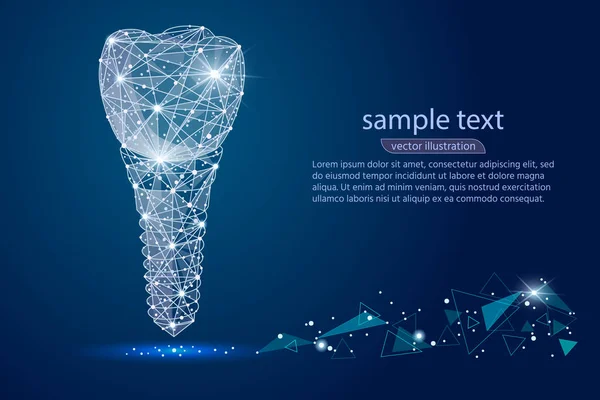 Abstrakt design tandimplantat ikon, isolerade från låg poly wireframe på bakgrunden av utrymme. Vector abstrakt polygonal bild mosar linje och punkt. Digital grafik — Stock vektor