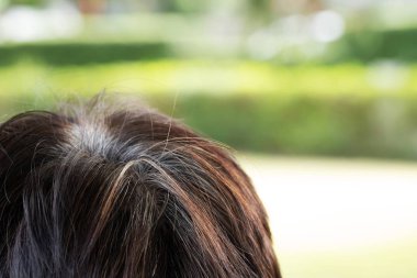 Back view of young people premature gray hair, showing black hoary hair roots on head change to senior old man outdoor. clipart