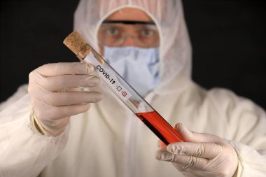 Koruyucu giysili ve maskeli doktor, hızla yayılan Coronavirus 'un pozitif kan testi sonucunu içeren cam bir tüp tutuyor. Küresel koronavirüs hastalığı (COVID-19) 2020.