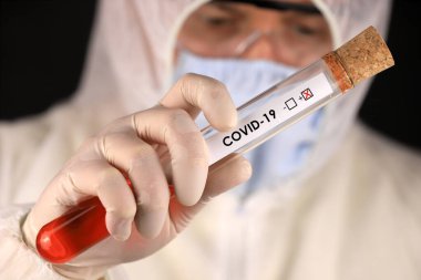 Koruyucu giysili ve maskeli doktor, hızla yayılan Coronavirus 'un pozitif kan testi sonucunu içeren cam bir tüp tutuyor. Küresel koronavirüs hastalığı (COVID-19) 2020.