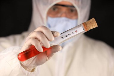 Koruyucu giysili ve maskeli doktor, hızla yayılan Coronavirus 'un pozitif kan testi sonucunu içeren cam bir tüp tutuyor. Küresel koronavirüs hastalığı (COVID-19) 2020.