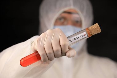 Koruyucu giysili ve maskeli doktor, hızla yayılan Coronavirus 'un pozitif kan testi sonucunu içeren cam bir tüp tutuyor. Küresel koronavirüs hastalığı (COVID-19) 2020.