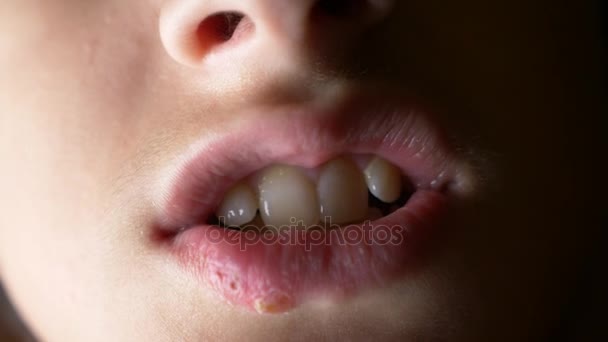 Herpes op de lippen van een jongen. herpes. lip behandeling. 4k, slow-motion-video schieten, ruimte kopiëren — Stockvideo