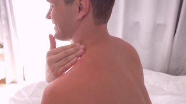 4 k. bir adam smear omuzlarını alınan, güneş yanığı, jel burns üzerinden. Kızarmış kaşıntılı cilt güneş yanığı sonra bir adamla smear krem cilt üzerinde. Ağır çekim