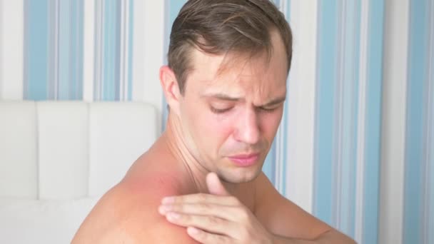 4 k. mężczyzna rozmazuje ramiona, otrzymali oparzenia słoneczne, żel od oparzenia. Człowiek z zaczerwieniona, swędząca skóra po opalaniu, rozmazuje krem na skórze. Zwolnionym tempie — Wideo stockowe