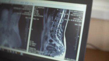 Doktor, hasta MRI makinesinde hareket ederken bilgisayar ekranına bakarak doktor onun laptop manyetik rezonans görüntüleme sonuçlarını analiz eder. 4k, arka plan bulanıklık