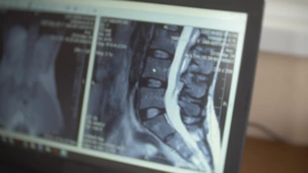 医師は mri 装置に患者を移動させながらコンピューターの画面を見て、医者は、彼のラップトップ上の磁気共鳴イメージングの結果を分析します。4 k、背景をぼかし — ストック動画