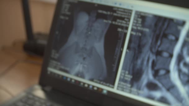 Врач, глядя на экран компьютера во время движения пациента в МРТ-машине, анализирует результаты магнитно-резонансной томографии на своем ноутбуке. 4K, размытие фона — стоковое видео