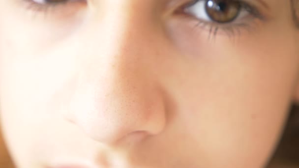 En person med en akne problem, närbild. Teenage hud, svarta prickar. 4k, Slowmotion — Stockvideo