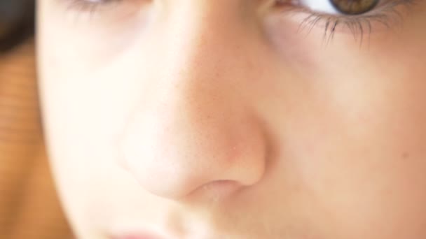Une personne avec un problème d'acné, gros plan. peau d'adolescent, points noirs. 4k, au ralenti — Video