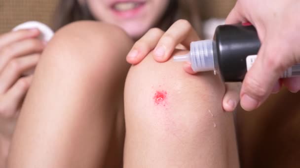 Genou blessé de l'enfant, abrasions sur les genoux des filles. Gros plan. Verser le peroxyde d'hydrogène sur l'abrasion. 4k. Mouvement lent — Video