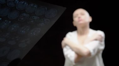 Onkolojik hasta, kel kadın ve doktor adam siyah arkaplanda tomografi sonuçlarını inceliyorlar..